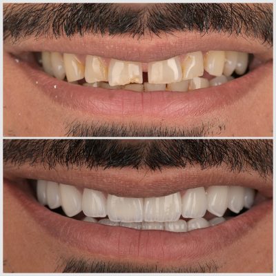 F96B6EF6-CF7A-4055-A3EA-2B9665504796 F96B6EF6-CF7A-4055-A3EA-2B9665504796